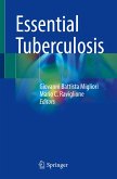 Essential Tuberculosis