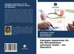 Gekippte Implantate für die Rehabilitation zahnloser Kiefer - ein Überblick - Venkat, Asweshya;V, Amalorpavam;Mithran, Akash