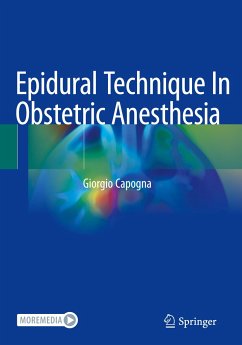 Epidural Technique In Obstetric Anesthesia - Capogna, Giorgio
