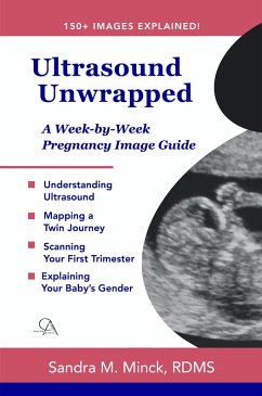 Cover Ultrasound Unwrapped: A Week-by-Week Pregnancy Image Guide (eBook, ePUB)