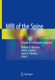 MRI of the Spine