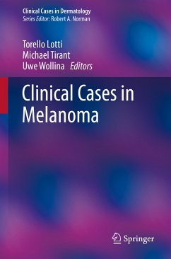 Clinical Cases in Melanoma (eBook, PDF)