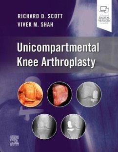 Unicompartmental Knee Arthroplasty - Scott, Richard D.; Shah, Vivek