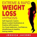 Extreme & Rapid Weight Loss Hypnosis (eBook, ePUB)