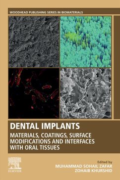 Dental Implants (eBook, ePUB) - Zafar, Muhammad; Khurshid, Zohaib