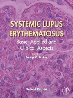 Cover Systemic Lupus Erythematosus (eBook, ePUB)