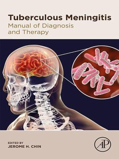 Cover Tuberculous Meningitis (eBook, ePUB)