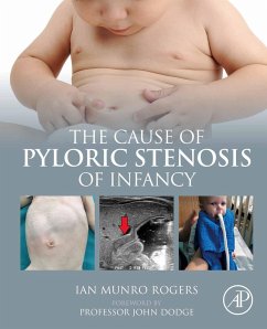 Cover The Cause of Pyloric Stenosis of Infancy (eBook, ePUB)