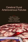 Cerebral Dural Arteriovenous Fistulas (eBook, ePUB)