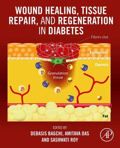 Cover Wound Healing, Tissue Repair, and Regeneration in Diabetes (eBook, ePUB)