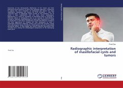 Radiographic interpretation of maxillofacial cysts and tumors