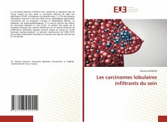 Les carcinomes lobulaires infiltrants du sein - KSENTINI, Meriem