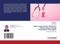 Early Lung Cancer Detection Using Various Image Processing Techniques - K, Nirmalakumari;R, Harikumar;C, Ganesh Babu