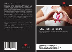 PET/CT in breast tumors - Serna Macias, José Antonio; Cabezas Ortiz, Cristian Alejandro; Ramírez Carpinteyro, Pamela