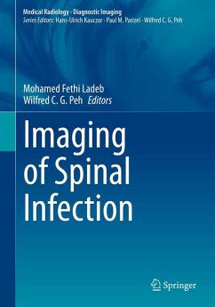 Cover Imaging of Spinal Infection (eBook, PDF)