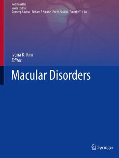 Macular Disorders