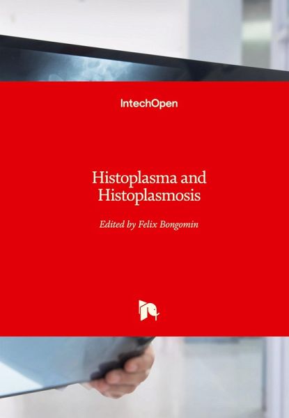 Histoplasma and Histoplasmosis Histoplasma and Histoplasmosis