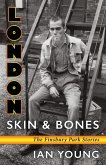 London Skin and Bones