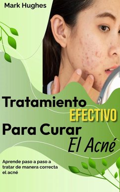 Tratamiento Efectivo Para Curar El Acné: Aprende paso a paso a tratar de manera correcta el acné (eBook, ePUB) - Hughes, Mark