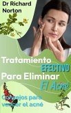 Tratamiento Efectivo Para Eliminar El Acné: Consejos para vencer el acné (eBook, ePUB)