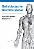 Radial Access for Neurointervention (eBook, ePUB)