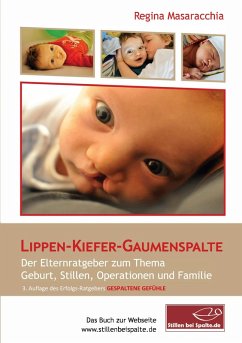 Lippen-Kiefer-Gaumenspalte (eBook, ePUB)