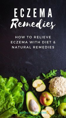 Eczema Remedies   How to Relieve Eczema With Diet & Natural Remedies (eBook, ePUB) - Stevens, Natalie J.