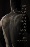 Kiss the Scars on the Back of My Neck (eBook, ePUB)