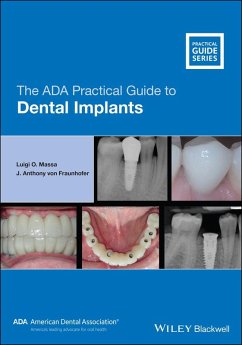 The ADA Practical Guide to Dental Implants (eBook, PDF) - Massa, Luigi O.; Fraunhofer, J. Anthony von