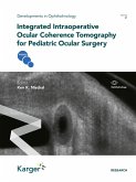 Integrated Intraoperative Ocular Coherence Tomography for Pediatric Ocular Surgery (eBook, PDF)