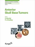 Anterior Skull Base Tumors (eBook, ePUB)