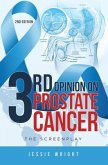 3rd Opinion on Prostate Cancer (eBook, ePUB)