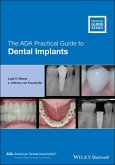 The ADA Practical Guide to Dental Implants (eBook, ePUB)