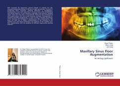 Maxillary Sinus Floor Augmentation