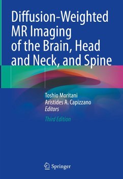 Diffusion-Weighted MR Imaging of the Brain, Head and Neck, and Spine (eBook, PDF)