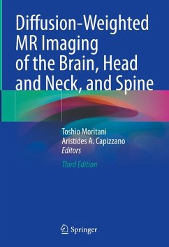 Cover Diffusion-Weighted MR Imaging of the Brain, Head and Neck, and Spine (eBook, PDF)