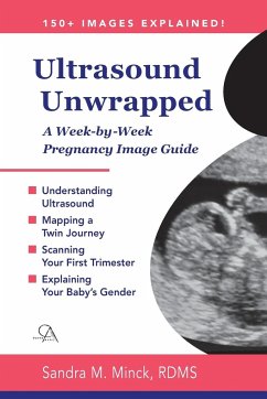 Ultrasound Unwrapped - Minck Rdms, Sandra M