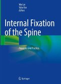 Internal Fixation of the Spine (eBook, PDF)
