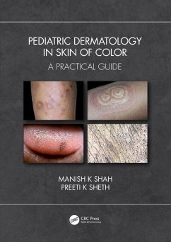 Pediatric Dermatology in Skin of Color (eBook, ePUB) - Shah, Manish K; Sheth, Preeti K