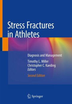 Stress Fractures in Athletes