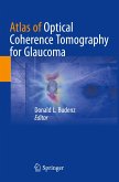 Atlas of Optical Coherence Tomography for Glaucoma