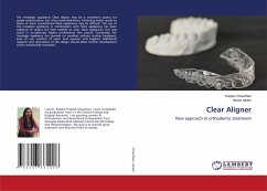 Clear Aligner