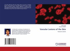 Vascular Lesions of the Skin - Riaz, Akhtar;QUAMAR, SHEEBA