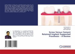 Screw Versus Cement Retained Implant Supported Prosthesis ¿ A Review - S, Krishnasuthan;A, Shyam Mohan;Rajambigai, Aarthi