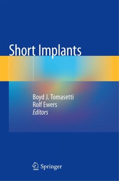 Short Implants