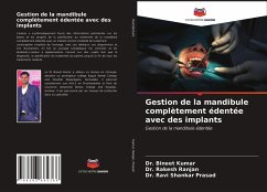 Gestion de la mandibule complètement édentée avec des implants - Kumar, Bineet; Ranjan, Rakesh; Prasad, Ravi Shankar