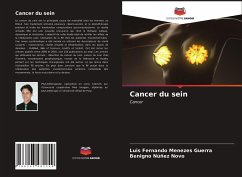 Cancer du sein - Guerra, Luis Fernando Menezes; Novo, Benigno Núñez