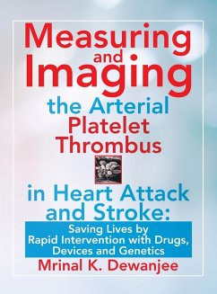 Measuring and Imaging the Arterial Platelet Thrombus in Heart Attack and Stroke: Saving Lives by Rapid Intervention with Drugs, Devices and Genetics - Dewanjee, Mrinal K.