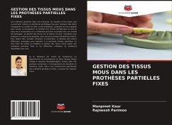 GESTION DES TISSUS MOUS DANS LES PROTHÈSES PARTIELLES FIXES - Kaur, Manpreet; Parimoo, Rajneesh