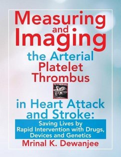 Measuring and Imaging the Arterial Platelet Thrombus in Heart Attack and Stroke: Saving Lives by Rapid Intervention with Drugs, Devices and Genetics - Dewanjee, Mrinal K.